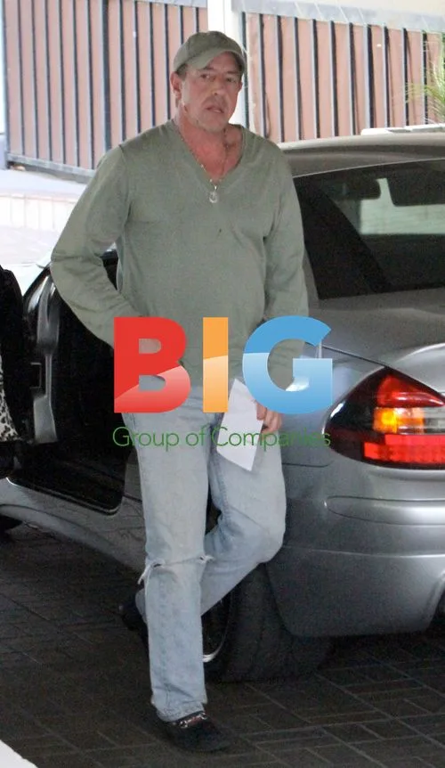 Michael Lohan with Facial Injury