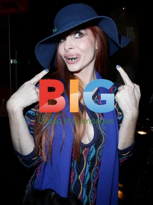 Phoebe Price Wearing Fake Teeth