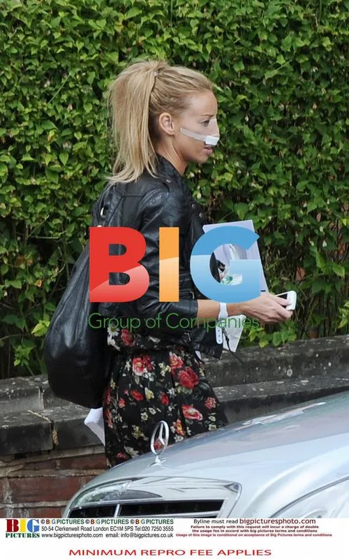 TOWIE stars post nose surgery
