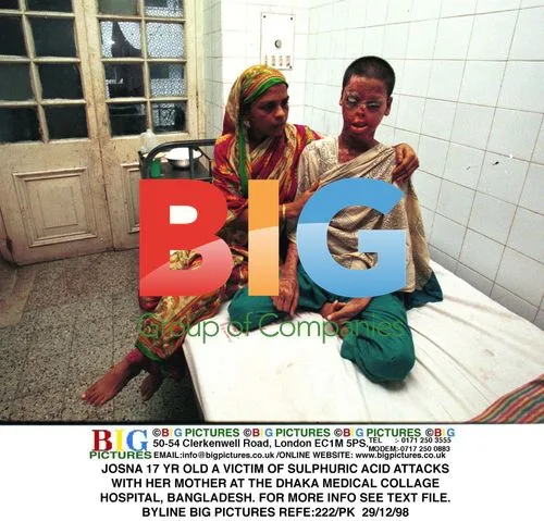 Josna, 17, Acid Attack Victim in Bangladesh