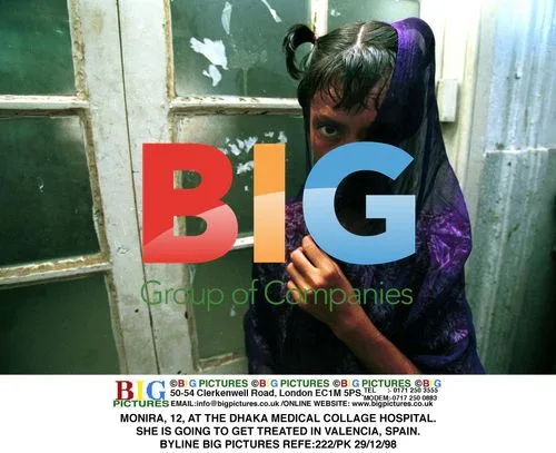 12-year-old Monira treated at Dhaka hospital