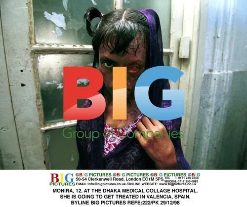 MONIRA, 12, Receiving Treatment in Spain