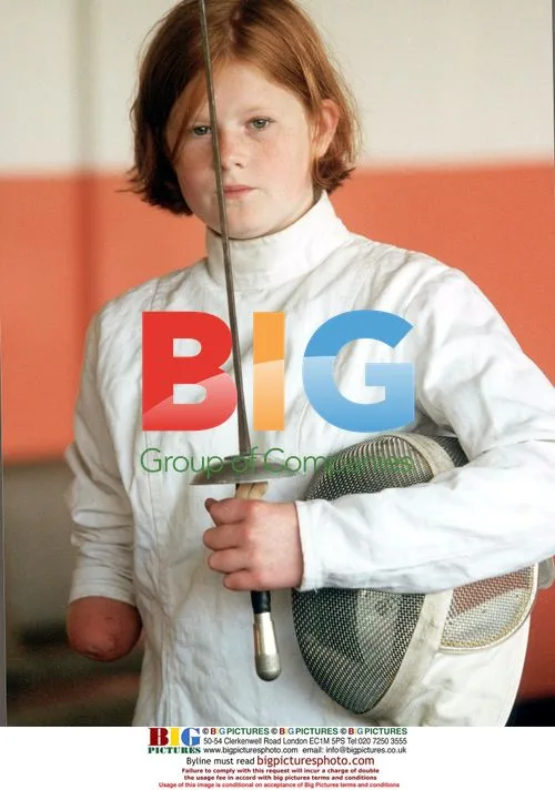 13 Year Old Louise Milligan with Congenital Defect