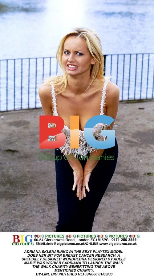 Adriana Sklenarikova Modeling for Breast Cancer