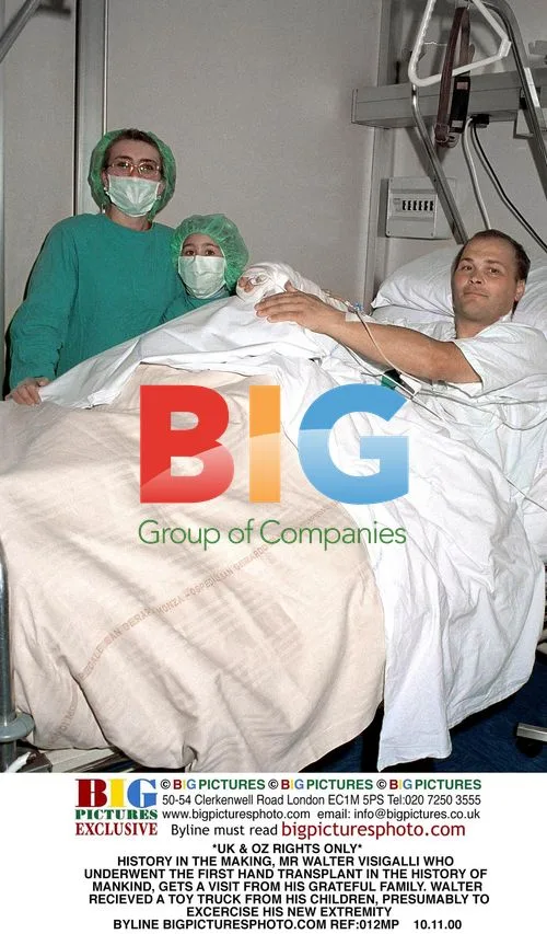 First Hand Transplant in History
