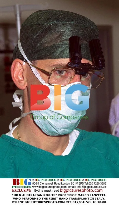 Professor Marco Lanzetta, First Hand Transplant in Italy