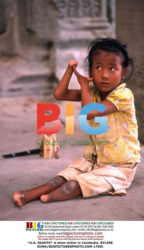 Mine victim in Cambodia