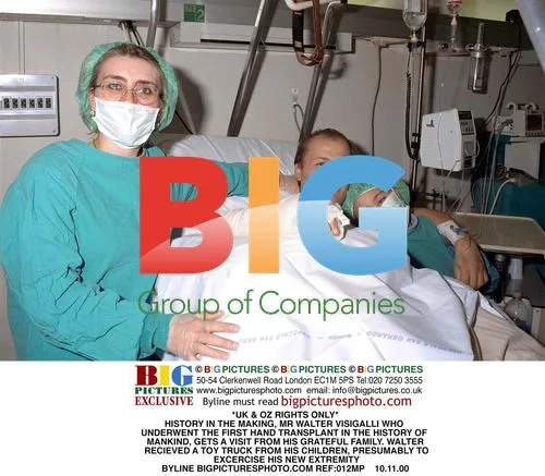 First Hand Transplant in History