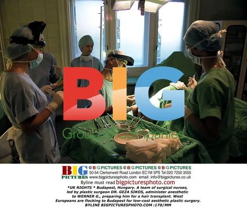 Surgical nurses administer anesthetic for hair transplant in Budapest