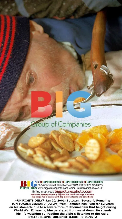 Romanian Man Spends Life on His Stomach