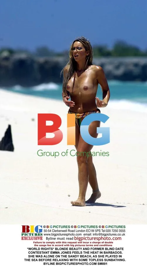 Emma Jones Sunbathes Topless in Barbados