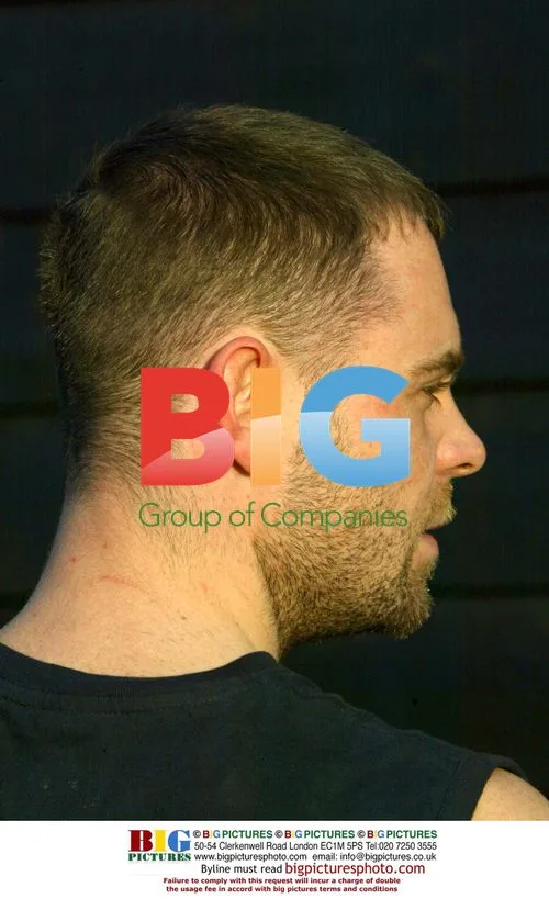 BRIAN HARVEY'S HEAD SCAR