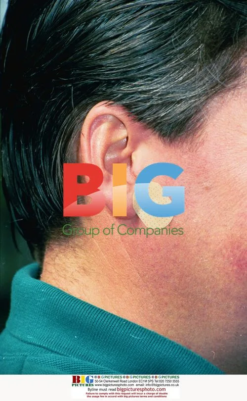 Dennis Wells Ear Magnet Portrait
