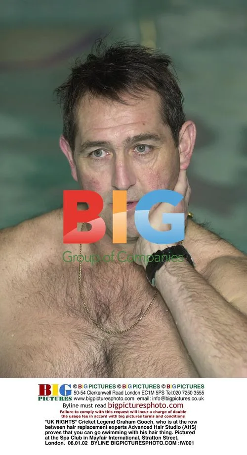 Cricket Legend Graham Gooch Proves Hair Replacement Durability
