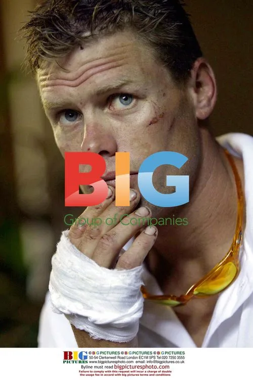 Footballer Damon Brimson with injuries from Bali bombing