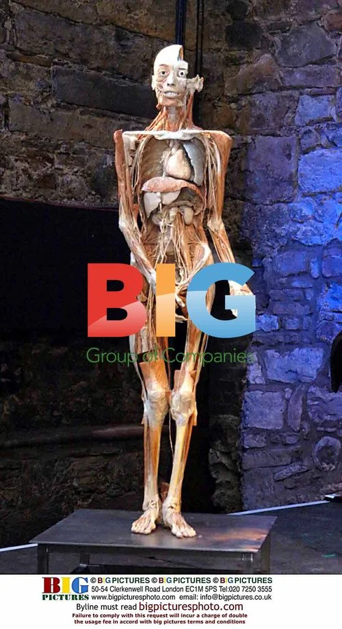Professor Gunther Von Hagens plastified body