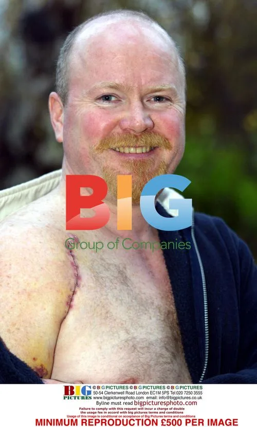EastEnders' Steve McFadden Injured Shoulder