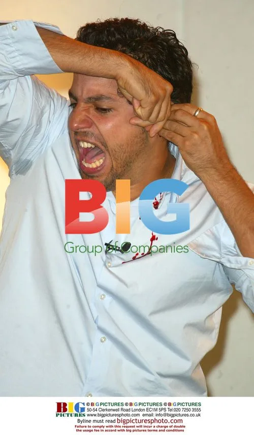 David Blaine Cuts Off Ear at Press Conference