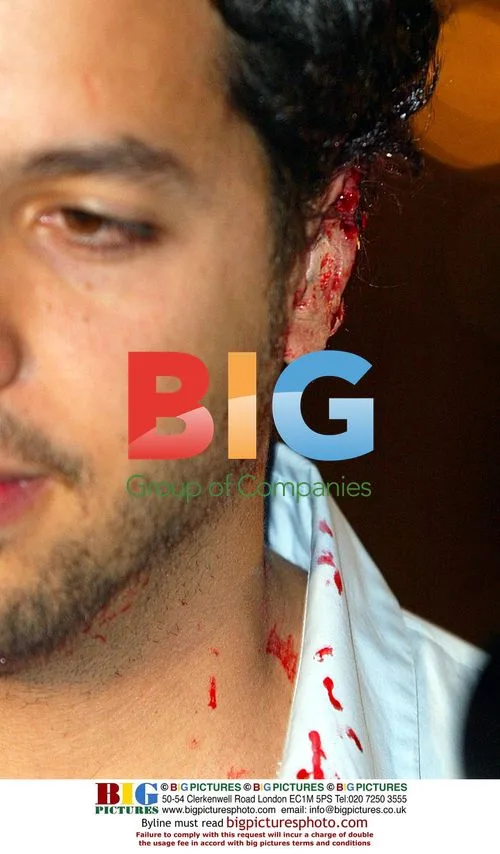 David Blaine Cuts Off Ear at Press Conference