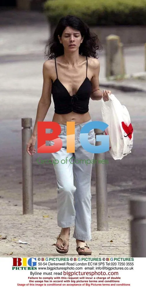 Former Model Josi Campos Living in Poverty