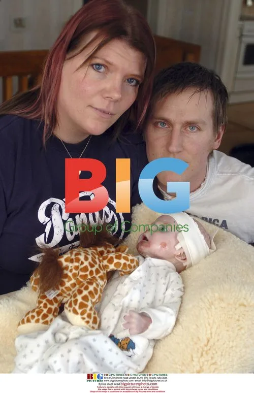 Baby Tille with rare fatal disease