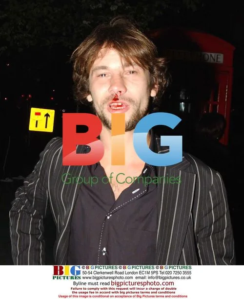Jay Kay Headbutted at Star Wars II Premiere After Party