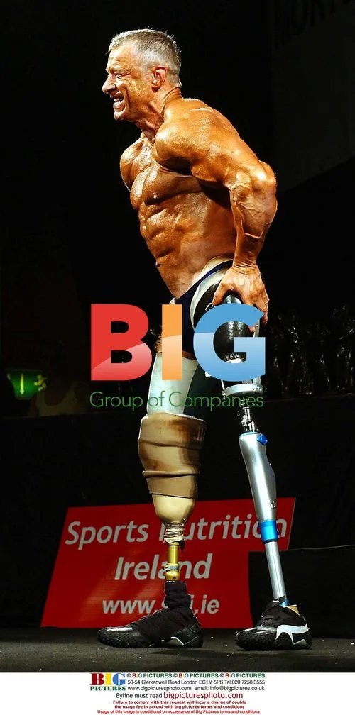 Amputee Michael Stewart at Mr. Ireland Universe