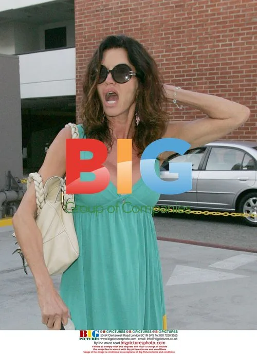 Janice Dickinson with swollen lip