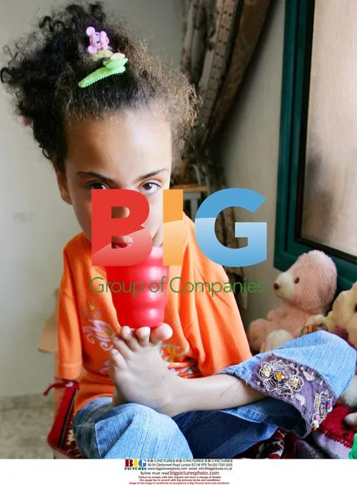 Palestinian girl Aya Wael Masoud, 9, born without arms