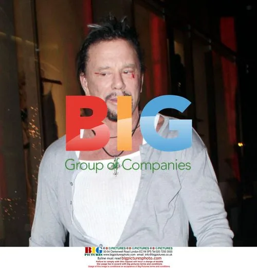 Mickey Rourke Leaves Gym with Bloody Face